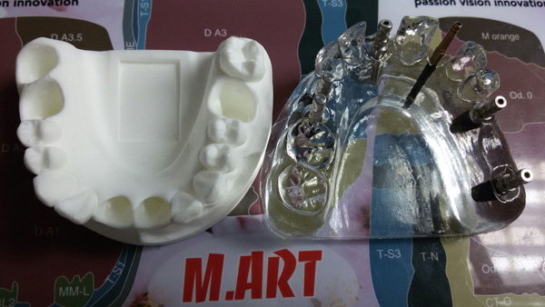 Изготовление пластмасовых моделей зубов разборные и не разборные, любой формы и цвета.